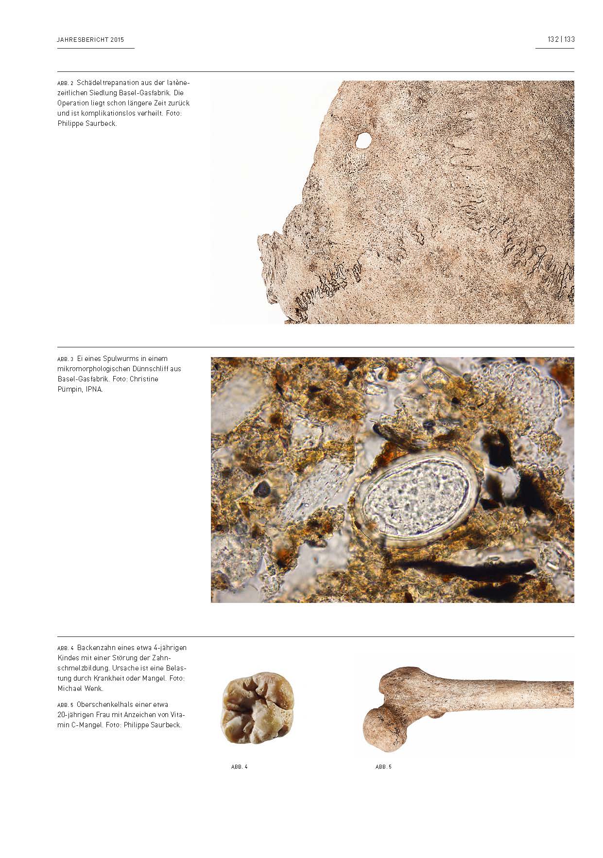 Abbildungen von menschlichen Skelettresten und von einem Ei eines Spulwurms