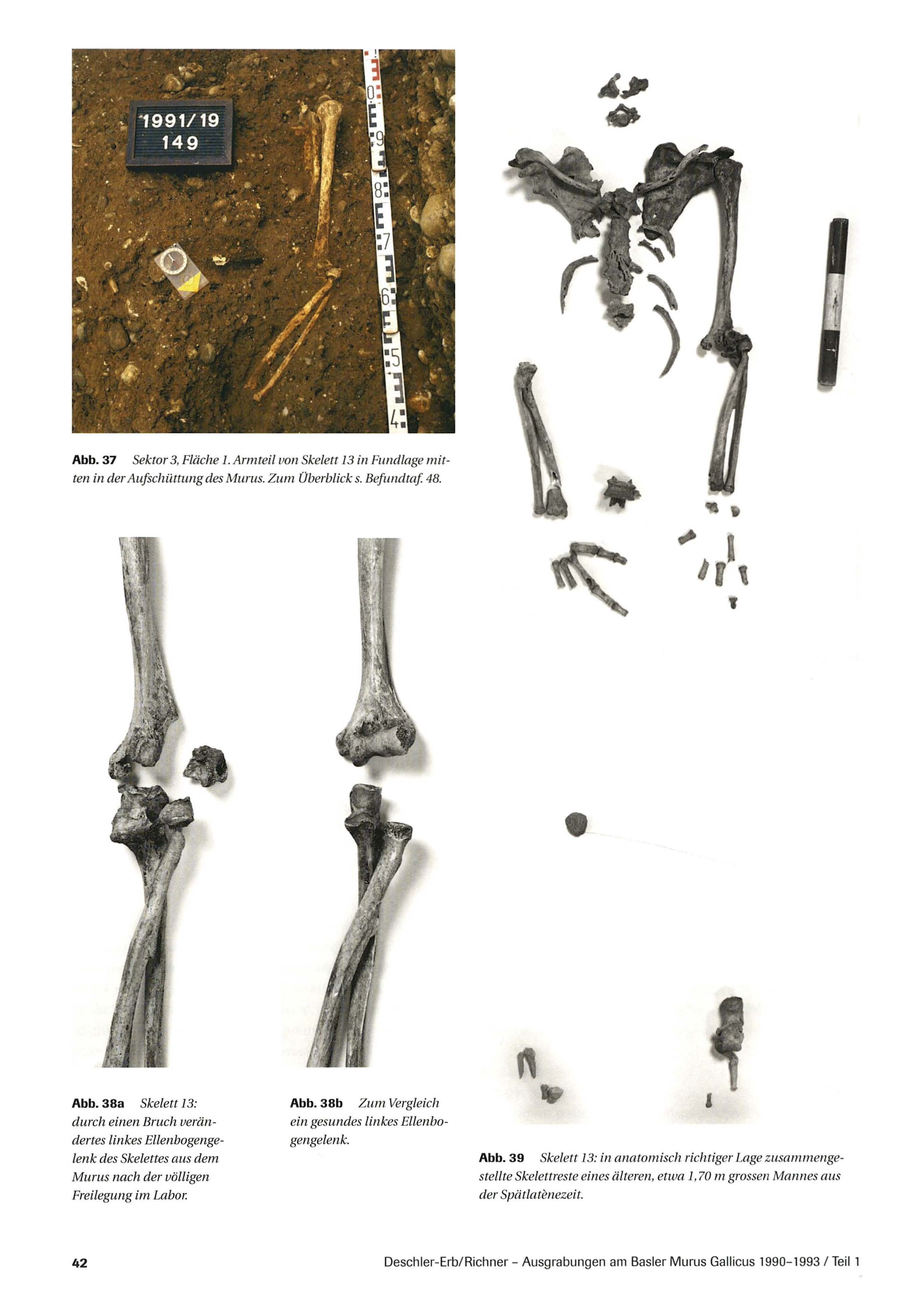 Das Skelett aus dem Murus Gallicus